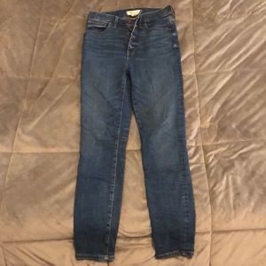 Madewell Button-Fly 11” High-Rise Skinny Jean